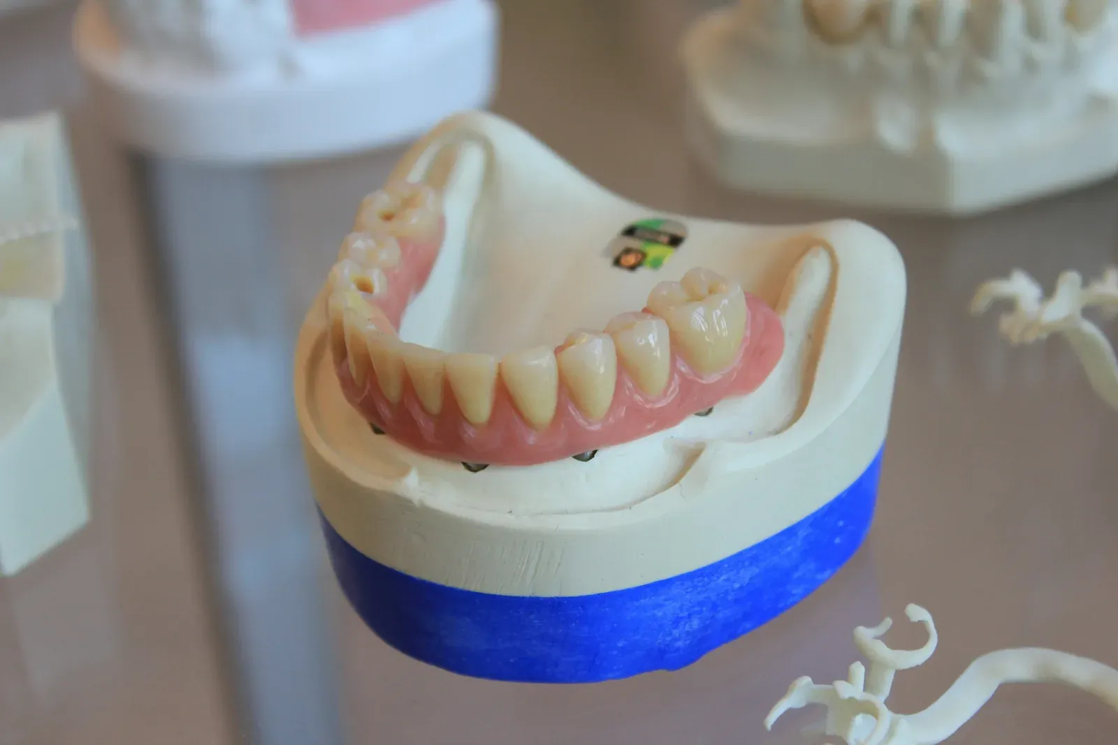 Modèle de mâchoire inférieure et de dents, pour illustrer les questions dentaires à vérifier
